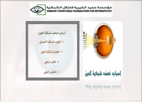 Decrease of eye retina