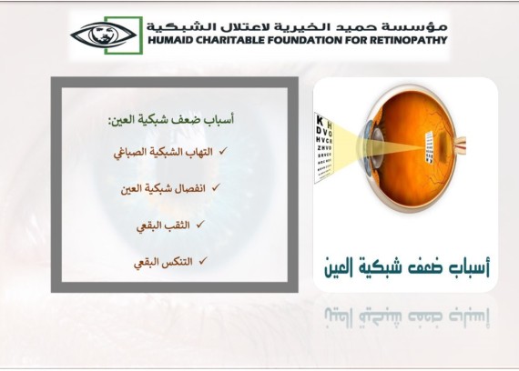Decrease of eye retina