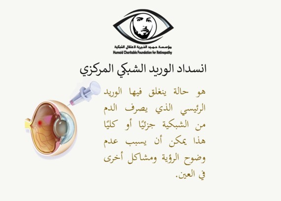 Central Retina blockage