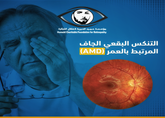 Dry age-related macular degeneration (AMD)