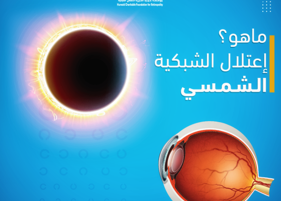 What is solar retinopathy?