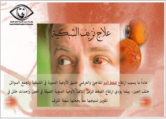 Causes of retina hemorrhage